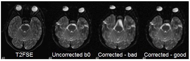 Possible instabilities in the brain stem area