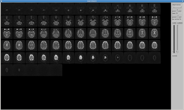 Data set raw images