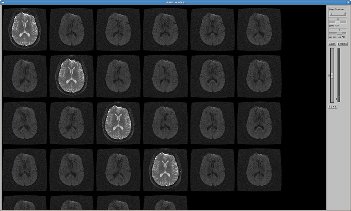 Raw image viewer magnification settings