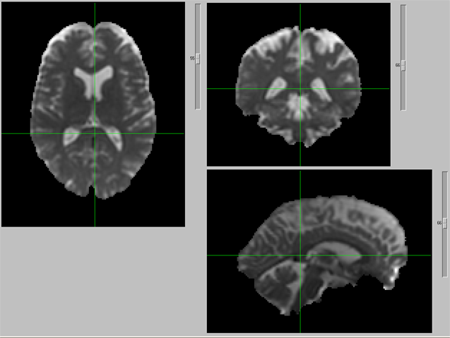 Crosshairs on images